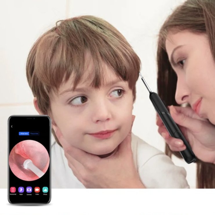 Endoscópio para limpeza dos ouvidos - Innovoda